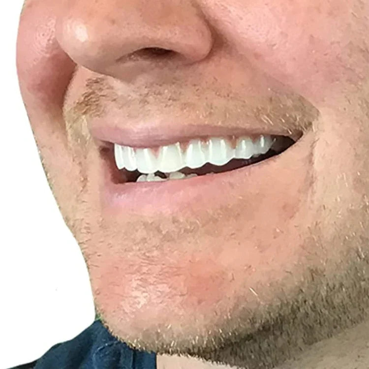 أداة تجميل لتغطية الأسنان الصناعية للابتسامة الفورية والراحة، غطاء أسنان مزيف مرن